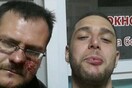 Επιτέθηκαν στον απεσταλμένο της “Καθημερινής” στην Κριμαία