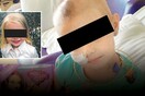 6 χρόνια φυλακή σε μητέρα που έδινε επικίνδυνα φάρμακα στην κόρη της για να τραβήξει την προσοχή