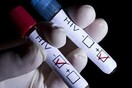 ΟΗΕ για τον HIV: Οι άνδρες με ερωτικούς συντρόφους του ιδίου φύλου έχουν 28 φορές περισσότερες πιθανότητες να προσβληθούν από τον ιό