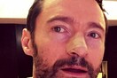 Ο Hugh Jackman μιλά για τον καρκίνωμα στη μύτη του και προειδοποιεί για τη χρήση αντηλιακού