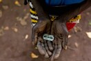 Η φρίκη της κλειτοριδεκτομής - 50 κορίτσια νοσηλεύονται με ακρωτηριασμένα γεννητικά όργανα στη Μπουρκίνα Φάσο
