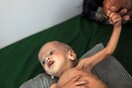 Λιμοκτονία στην Υεμένη - Σκοτώνουν μια ολόκληρη γενιά παιδιών