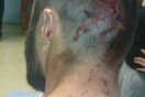 «Μας έφεραν 31 διαδηλωτές, όλοι με χτυπήματα στο κεφάλι»