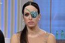 Η Gessica Notaro έχασε το μάτι της σε επίθεση με οξύ - τώρα θέλει να ακουστεί το μήνυμά της