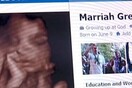 To Facebook έσβησε τη σελίδα μωρού που δεν έχει γεννηθεί ακόμα
