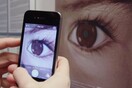 Τα smartphones μπορούν να εντοπίσουν μορφή καρκίνου του ματιού