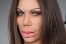 Τι συνέβη στη Στικούδη; - «Botox» δια χειρός αδελφών Αλαχούζων