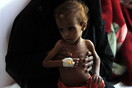 Η πείνα σκοτώνει στην Υεμένη - 85.000 μικρά παιδιά νεκρά από υποσιτισμό