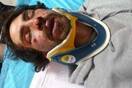 Απολογείται σήμερα το στέλεχος της Χρυσής Αυγής για τον άγριο ξυλοδαρμό του φοιτητή