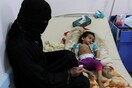 ΟΗΕ: Σχεδόν 2 εκατομμύρια παιδιά υποφέρουν από οξύ υποσιτισμό στην Υεμένη