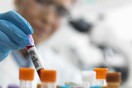 HIV: Ο δεύτερος παγκοσμίως ασθενής που φαίνεται να θεραπεύτηκε