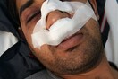 Νέα ρατσιστική επίθεση σε μετανάστη - Αυτή τη φορά στο Γαλάτσι