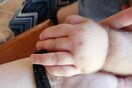 Ισπανία: Μωρά εμφάνισαν το «σύνδρομο του λυκάνθρωπου» μετά από μπέρδεμα σε φάρμακα