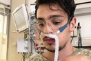 TikTok: 23χρονος κατέγραψε σε βίντεο τη μάχη του με τον κορωνοϊό -21 ημέρες στο νοσοκομείο, «δεν είναι αστείο»