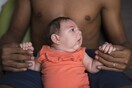 Αυξάνονται ανησυχητικά στη Βραζιλία τα νεογέννητα μωρά με μικρό κεφάλι λόγω του ιού Ζίκα