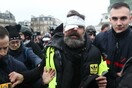 «Ανάπηρος ισοβίως» - Ηγετική μορφή των Κτρινων Γιλέκων τραυματίστηκε σοβαρά στο μάτι
