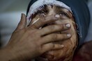 40 συγκλονιστικές φωτογραφίες: Αίμα και Χάος στη Συρία 