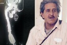 [ΝSFW] Πώς είναι να ζεις με μισό μέτρο πέος - Ο απίστευτος Μεξικανός με την πρωτοφανή ανατομία αποκαλύπτει