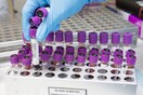 AstraZeneca: Ξεκινούν πάλι στις ΗΠΑ οι κλινικές δοκιμές του εμβολίου