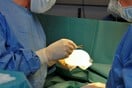 Άρειος Πάγος: Αποζημίωση 13.000€ σε γυναίκα για 4 αποτυχημένες πλαστικές επεμβάσεις στο στήθος