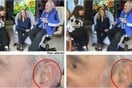 «Εξαφανίστηκαν» από φωτό τα ακουστικά βαρηκοίας του Φιντέλ Κάστρο