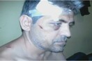 Δραματική αύξηση των ρατσιστικών επιθέσεων