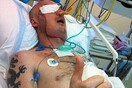 Επιτυχής η πρώτη μεταμόσχευση προσώπου στην Πολωνία