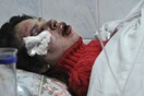 Η Ουκρανή δημοσιογράφος περιγράφει τον άγριο ξυλοδαρμό της