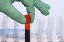 Τα 4 εκατομμύρια θα φτάσουν οι καρκινοπαθείς στην Ευρώπη μέχρι το 2025