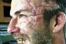 Η τρομακτική φωτογραφία του Ντέιβιντ Μπέκαμ και η έκπληξη που αποκάλυψε