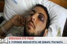 Καταγγελία για άγριο ξυλοδαρμό 17χρονου από πορτιέρηδες club στο Γκάζι