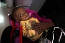 Προειδοποίηση ΟΗΕ για την Υεμένη: 8,4 εκατ. άνθρωποι είναι «ένα βήμα πριν τον λιμό»