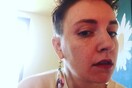 H Lena Dunham (σχεδόν) ξύρισε το κεφάλι της και το διαδίκτυο απορεί