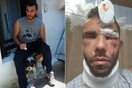 Βρήκαν τους δράστες που ξυλοκόπησαν άγρια τον 30χρονο Ηλία Καπώνη στο Ρέθυμνο