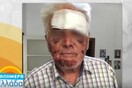 Άγριος ξυλοδαρμός 90χρονου στο Γαλάτσι για να του κλέψουν 5 ευρώ (ΒΙΝΤΕΟ)