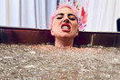 Ακτινογραφία σε όλο το σώμα της Lady Gaga μετά την σοκαριστική πτώση