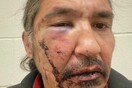 Κατακραυγή στον Καναδά από τη βίαιη σύλληψη Καναδού αυτόχθονα - Τριντό: «Σοκαριστικό»