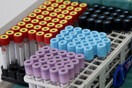 Κορωνοϊός στην Ελλάδα: 2.190 κρούσματα και 37 θάνατοι σε 24 ώρες- 348 διασωληνωμένοι 