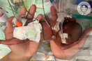 Αγοράκι στην Αλαμπάμα είναι το πιο πρόωρο βρέφος που επέζησε- Γεννήθηκε 420 γραμμάρια