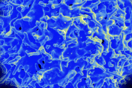 Why It Is Hard to Know Who Needs a Covid Booster: Mysterious T Cells
