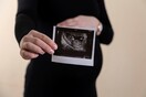 Τζόρτζια: Τα έμβρυα μπορούν να αναγράφονται ως εξαρτώμενα μέλη στις φορολογικές δηλώσεις
