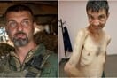 Το αποστεωμένο πρόσωπο της αιχμαλωσίας: Ένας Ουκρανός πριν και μετά τη σύλληψή του από τους Ρώσους