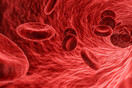 Για πρώτη φορά εργαστηριακά αιμοκύτταρα εγχύθηκαν επιτυχώς σε ανθρώπους