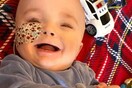 Baby given one day to live reaches first birthday