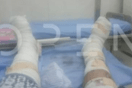 Σουδάν: «Δεν έχει σταματήσει η αιμορραγία» λέει Έλληνας τραυματίας