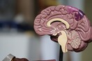 Αλτσχάιμερ: Ποιοι τύποι εγκεφάλων κινδυνεύουν περισσότερο- Το καινοτόμο τεστ αίματος