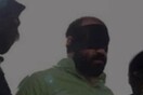 Ιράν: Ακρωτηρίασαν τα δάχτυλα σε δύο άνδρες που είχαν καταδικαστεί για κλοπή