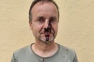 Ζάκυνθος: Άγρια επίθεση σε εθελοντές από λαθροθήρες που κυνηγούσαν τρυγόνια