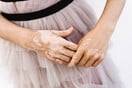 Ο δερματολόγος μπορεί να βοηθήσει στην αντιμετώπιση της λεύκης