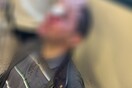 Εισβολή κουκουλοφόρων στη Νομική: Πώς έγινε η επίθεση - «Δεν έχω ξαναδεί τόση βία»